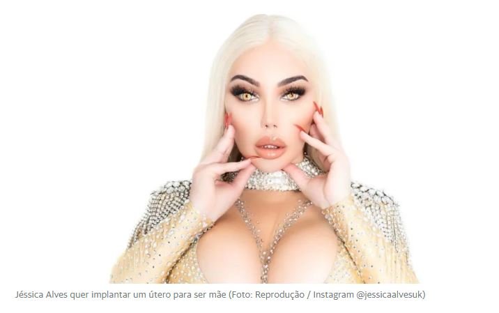 Trans Jéssica Alves, ex-Ken Humano, quer implantar útero por R$ 221 mil