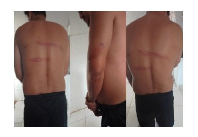 Homem denuncia seguranças de rodeio por tortura com choque em MT