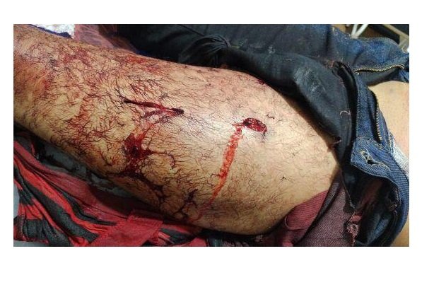 Homem morre esfaqueado durante discussão com mulher em assentamento