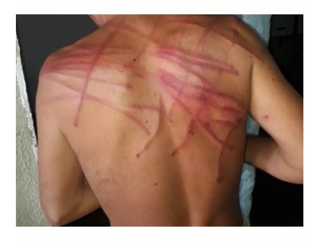 Homem procura polícia para denunciar surra de chicote que levou do patrão