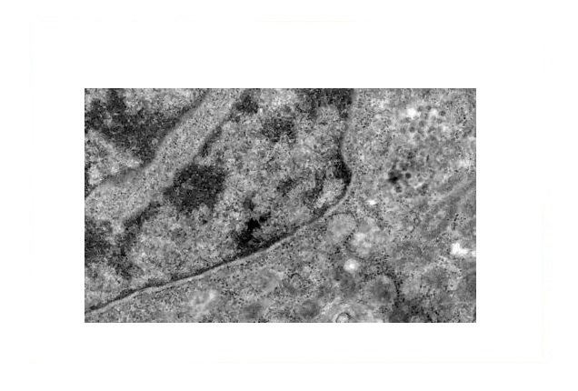 Cientistas descobrem subvariante da Ômicron ainda mais infecciosa