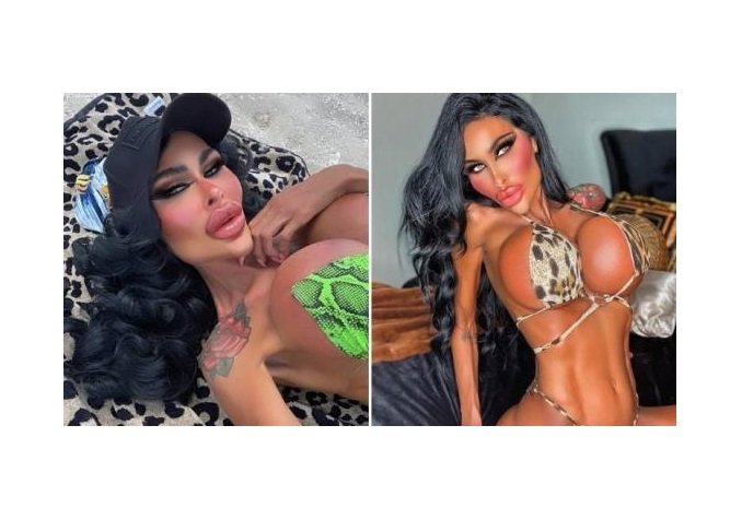 'Barbie' australiana gastou mais de R$ 1 milhão em cirurgias plásticas