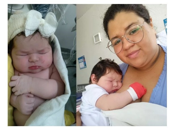 Mulher desconfia de pedra nos rins e descobre bebê de quase 5 kg