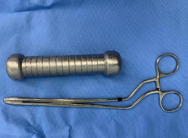Homem passa por cirurgia após enfiar peso de academia, de 2 quilos, no ânus