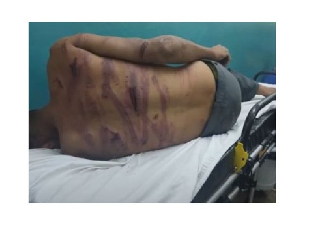 Vítima de salve descreve momentos de terror em MT; vídeo
