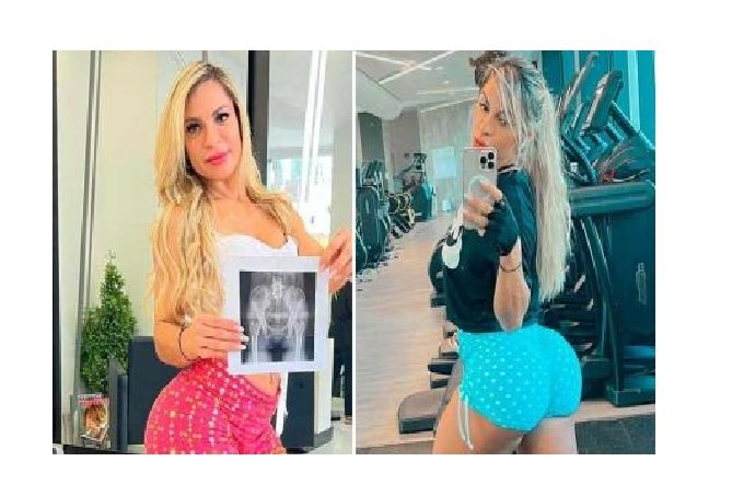 Candidata ao Miss Bumbum prova que bumbum é natural