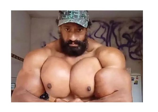 Hulk brasileiro injetava óleo mineral para ficar com músculos enormes