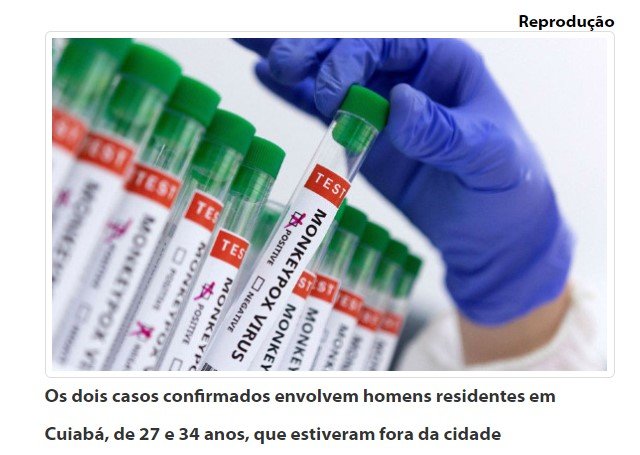 Varíola dos macacos põe Saúde Pública em estado de alerta máximo