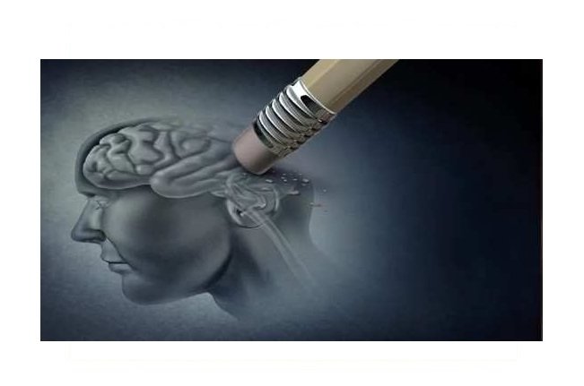Alzheimer começa sem sintoma de demência; veja as 7 fases da doença