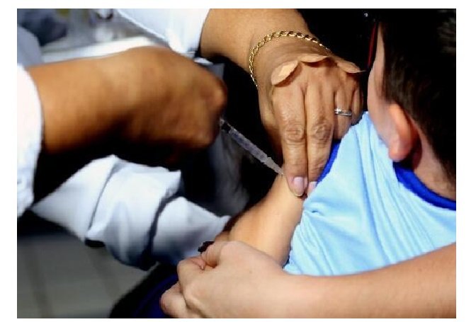 Vacinação contra poliomielite em Mato Grosso atinge apenas 52%