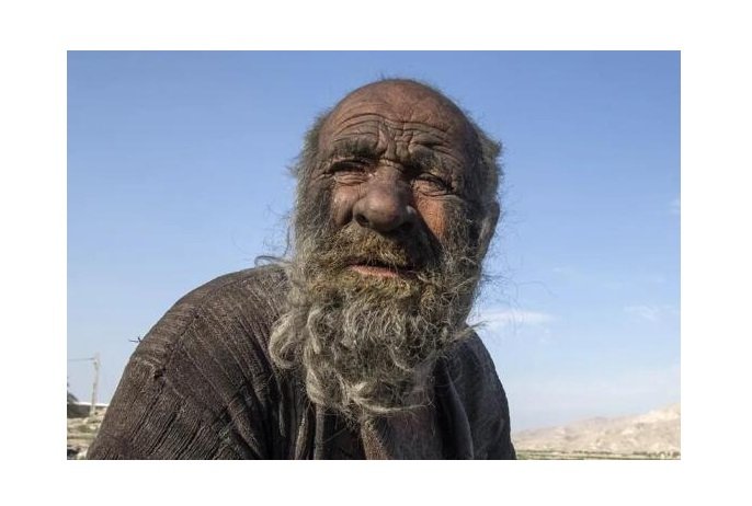 Homem conhecido como 'o mais sujo do mundo' morre no Irã meses depois de tomar banho