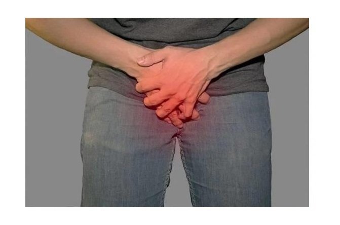 Homem é diagnosticado com chifre no pênis; veja a foto