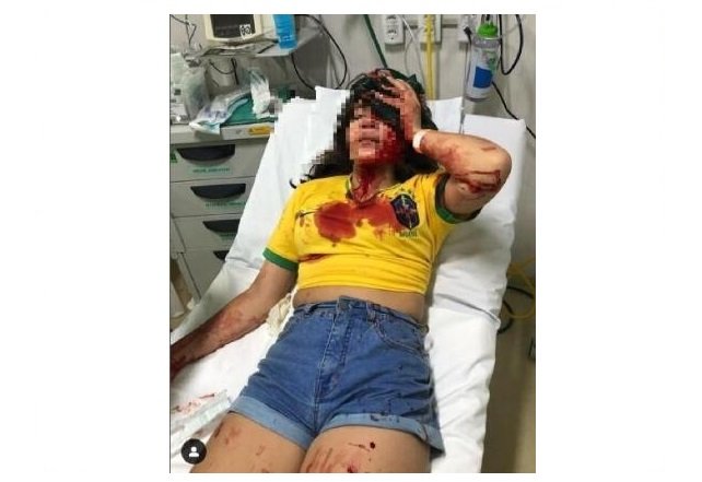 Menina de 13 anos leva pedrada na cabeça e mãe acusa petistas;