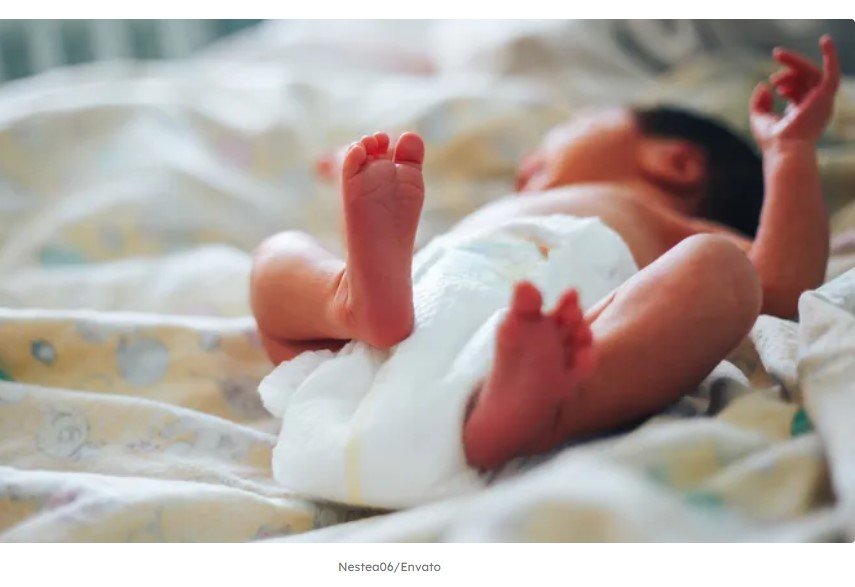 Raríssimo! Bebê nasce com cauda peluda de 6 centímetros