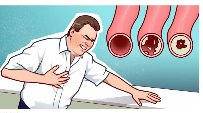 8 remédios caseiros simples que ajudam a limpar suas artérias