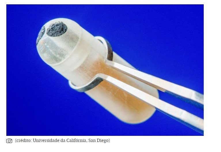 Cápsula ingerível monitora intestino e pode ser alternativa à endoscopia