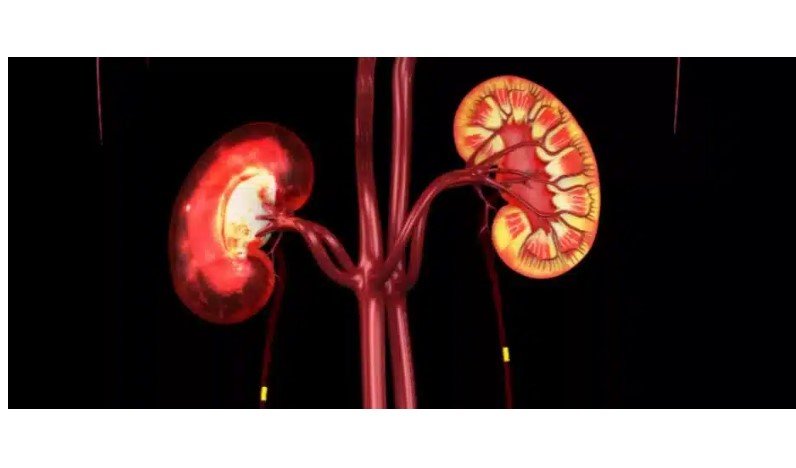 Pela primeira vez, rins de porco transplantados para um ser humano fornecem função de manutenção da vida