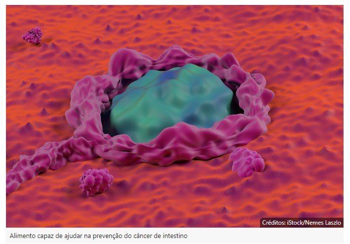 Alimento que todos têm em casa reduz risco de câncer de intestino, diz pesquisa