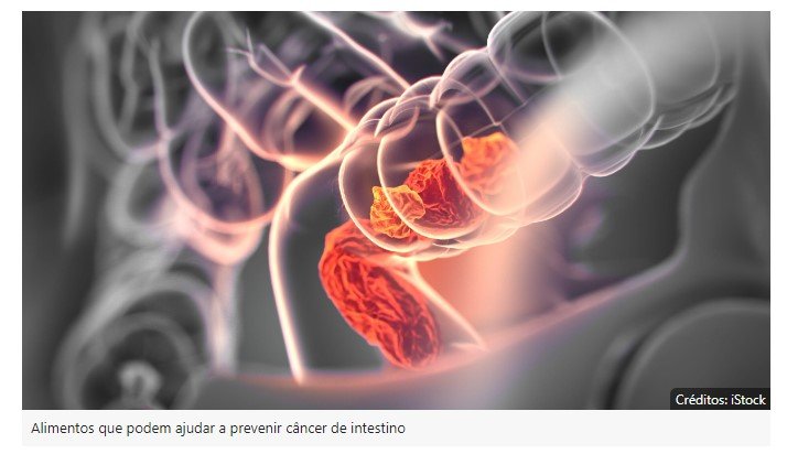 Estudo indica quais alimentos ajudam a evitar câncer de intestino