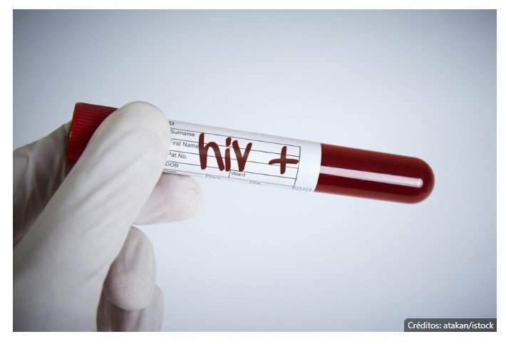 Descoberta variante genética que parece limitar a infecção pelo HIV