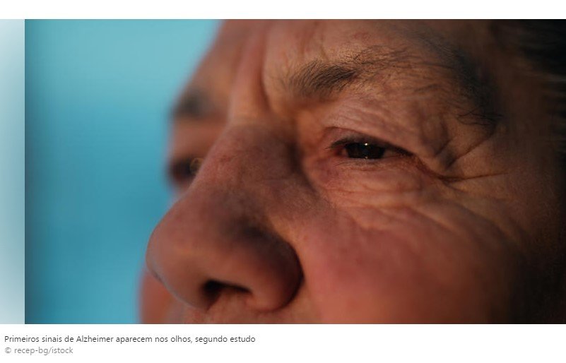 Estudo revela que os primeiros sinais de Alzheimer aparecem nos olhos