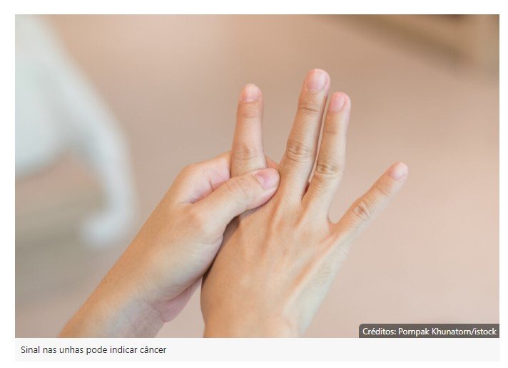 Sinal pouco reconhecido nas unhas pode sugerir câncer agressivo