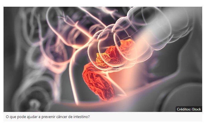 Saiba qual vitamina ajuda a reduzir risco de câncer de intestino