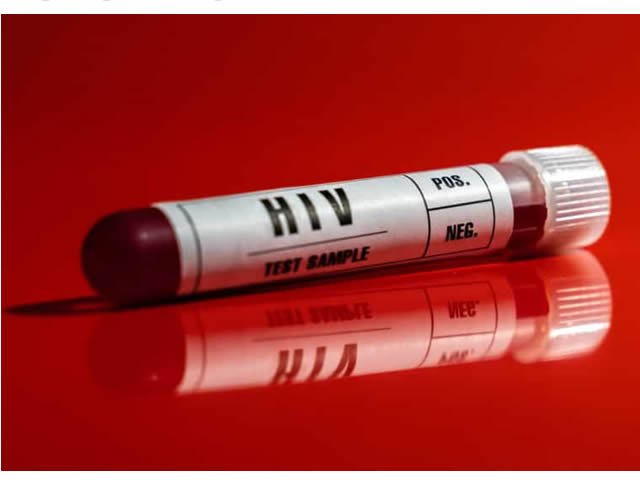 UFMG procura voluntários para teste de vacina contra o vírus HIV