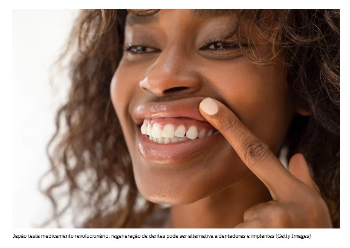 Japão testa medicamento que faz crescer dentes perdidos em humanos