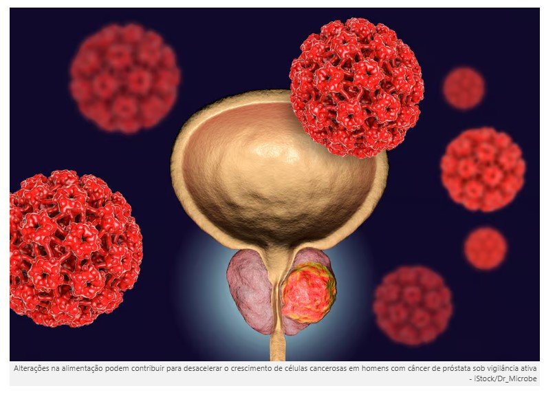 Estudo aponta nutriente que conseguiu reduzir o crescimento de tumor de próstata