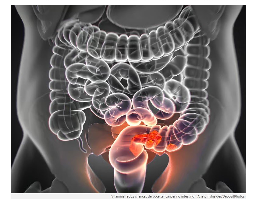 Estudo britânico revela que o consumo desta vitamina reduz o risco de câncer no intestino