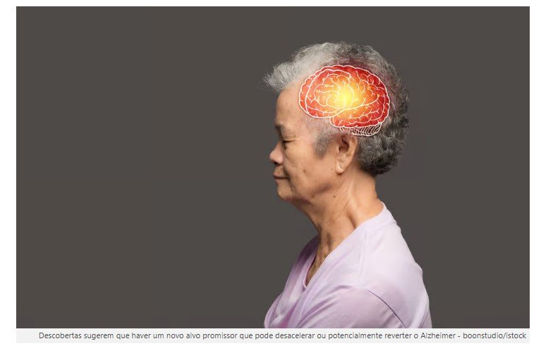 Cientistas descobrem caminho que pode reverter o Alzheimer