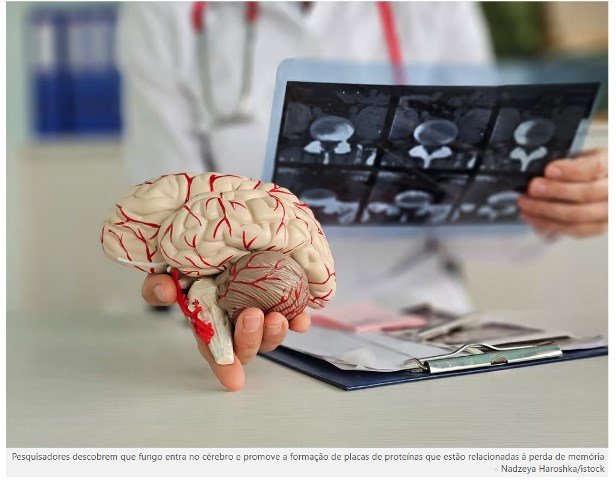 Estudo descobre ligação entre fungo e Alzheimer
