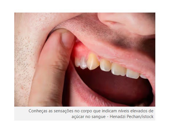 Como detectar e controlar o açúcar elevado no sangue