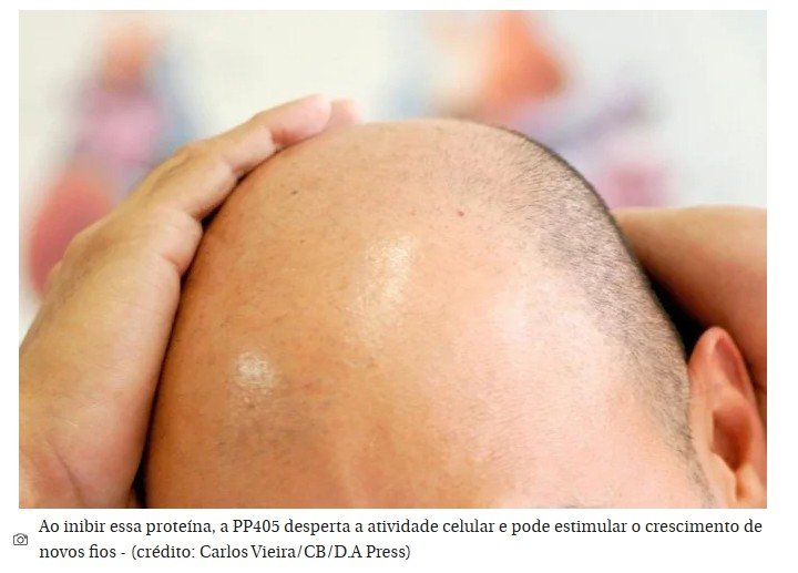 Fim dos carecas? Cientistas criam produto que faz o cabelo voltar a crescer