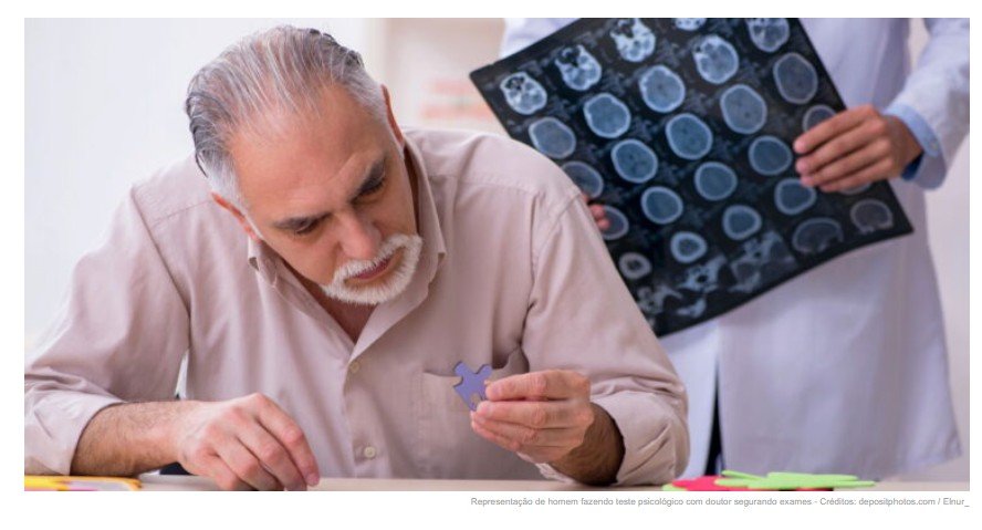 Neurologista com PHD em Harvad: 'Dormir desta maneira abre caminho para Alzheimer'