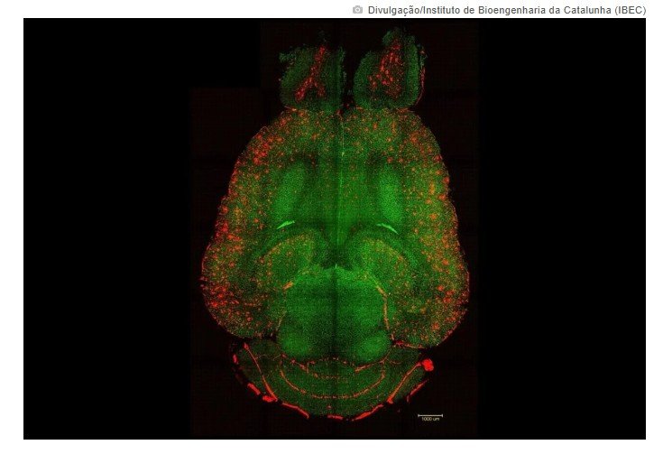 Cientistas revertem Alzheimer em camundongos usando nanopartículas