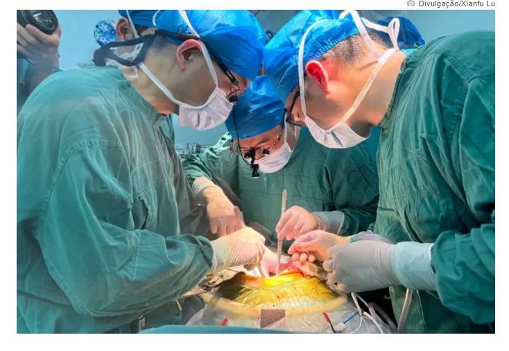 Fígado de porco modificado é transplantado a pessoa viva pela 1ª vez