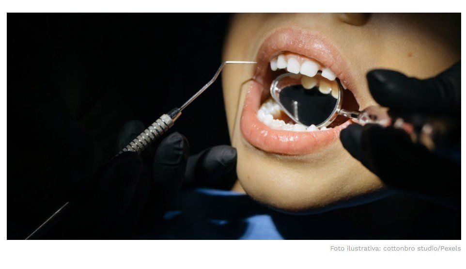 Não são as cáries: esse é o principal problema dentário nas crianças