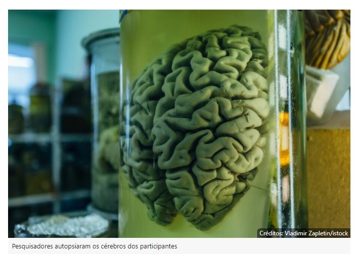 Estudo descobre alimento que pode tornar o cérebro mais jovem