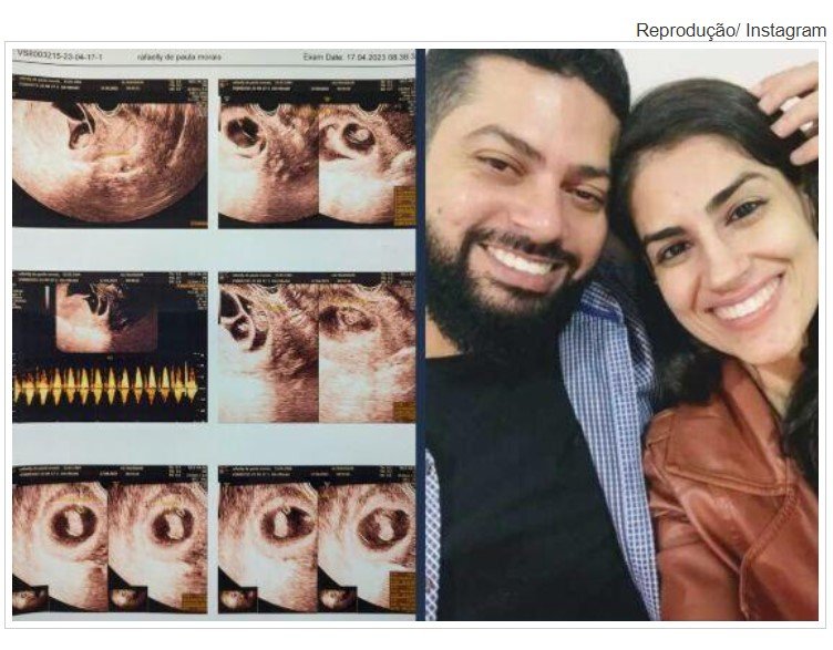 Casal mato-grossense descobre gestação raríssima de quíntuplos e precisa de ajuda