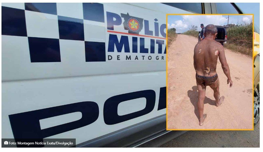 Homem que queimou ex-companheira em Paranaíta é indiciado pela Polícia Civil por homicídio qualificado
