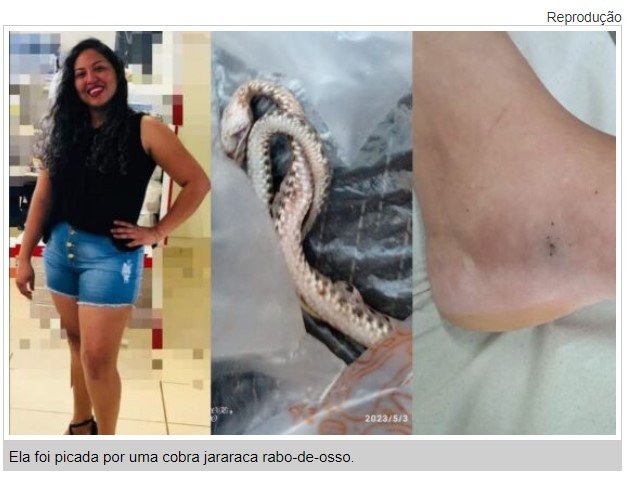 Mulher que morreu ao ser picada por cobra recebeu soro antiofídico, diz médico