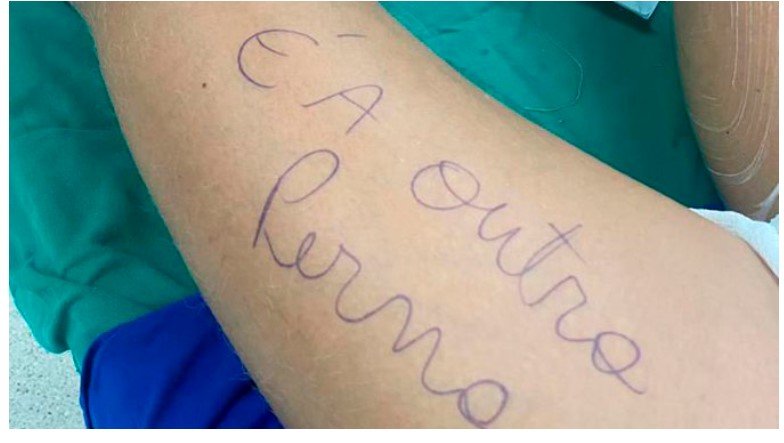 Com medo de erro médico mas escreve aviso na perna