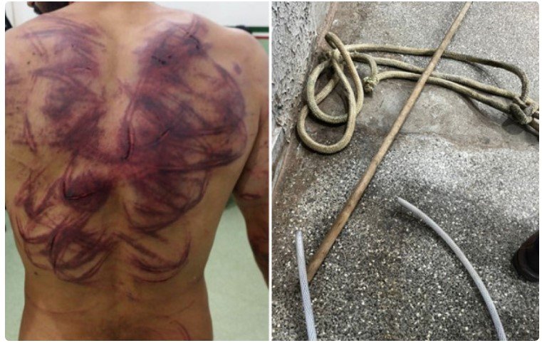 Homem tem as costas retalhadas em 'salve' do Comando Vermelho em cidade de MT