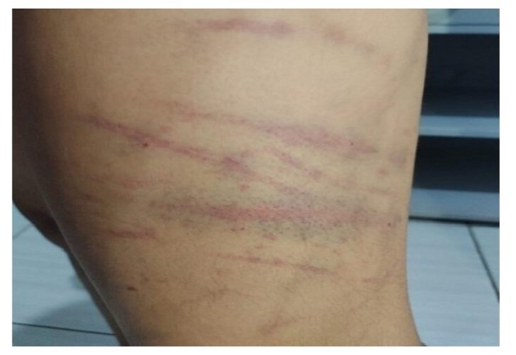 Após denúncia, mulher é presa por agredir filho de 9 anos