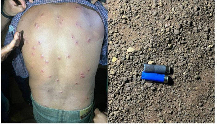 Indígenas são baleados por seguranças de hidrelétrica em Mato Grosso.
