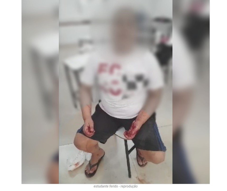 Aluno autista é agredido pelo professor após surtar em sala de aula em Sinop