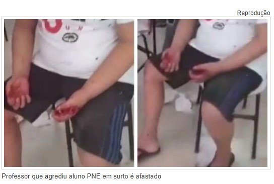 Professor que agrediu aluno PNE em surto é afastado da sala de aula