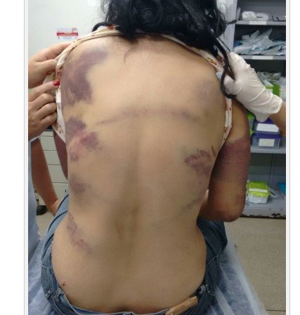 Menor de 15 anos é rendida e torturada por facção criminosa em Nova Monte Verde